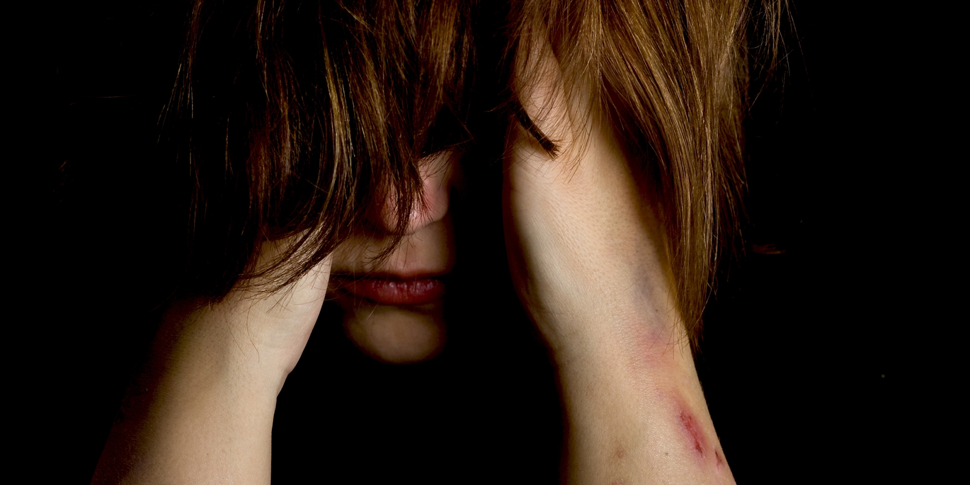 Jente som skjuler ansiktet med hår, skader på armen.